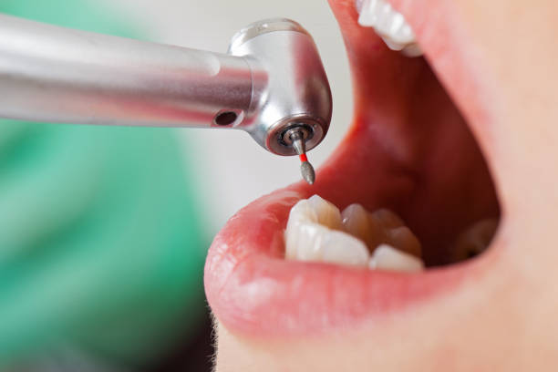 Best Emergency Denture Repair in Chanute, KS